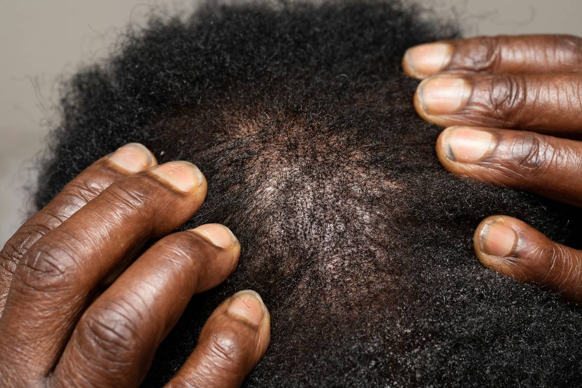 Why Breathable Design in Hair Headbands Isn’t Just a Buzzword—It’s Your Scalp’s Lifeline